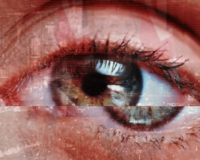 Distorted eye image