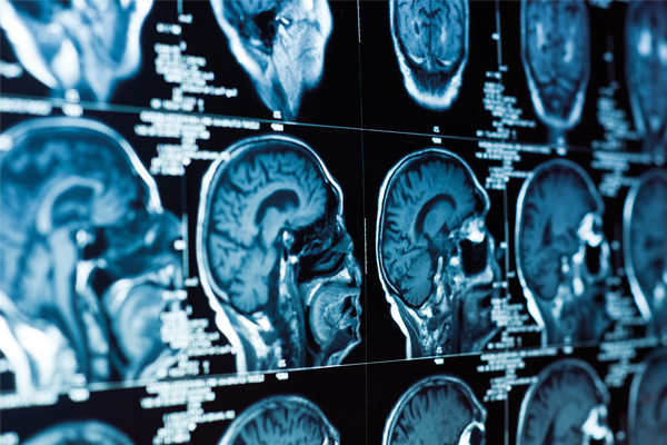 A screen of brain scans